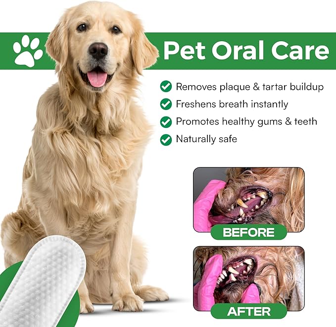 Dog Teeth Cleaning Wipes, Fights Plaque, Freshens Breath & Promotes Gum Health, No-Rinse Finger Toothbrush, Gentle & Naturally Safe, Completes Your Dog Tooth Brushing Kit, 50 Count